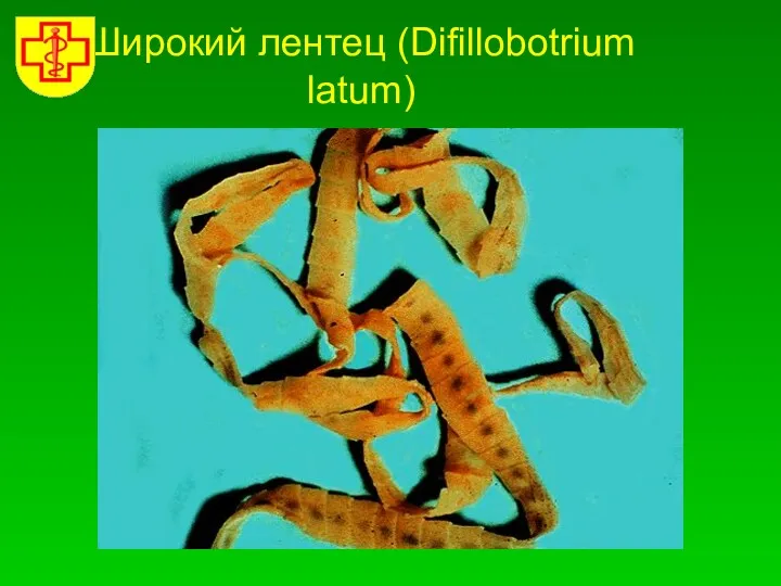 Широкий лентец (Difillobotrium latum)