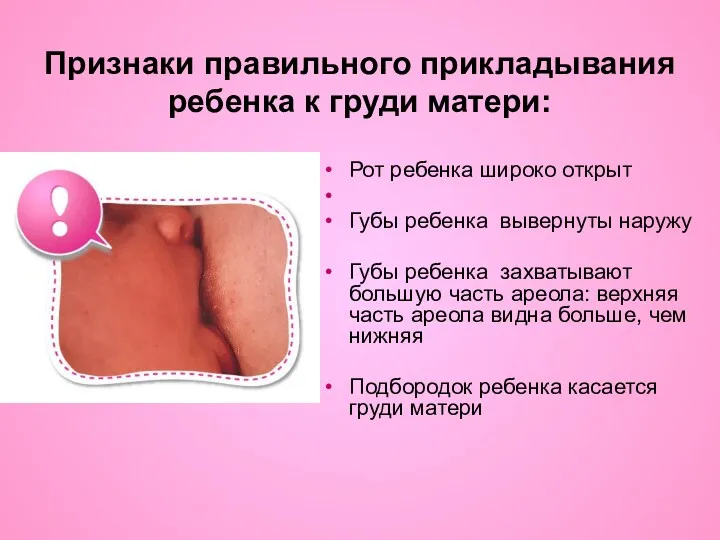 Признаки правильного прикладывания ребенка к груди матери: Рот ребенка широко