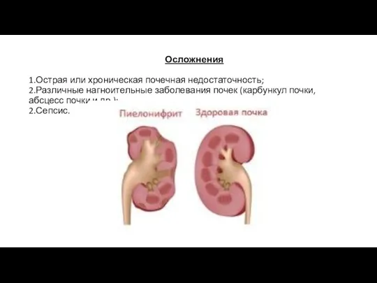 Осложнения 1.Острая или хроническая почечная недостаточность; 2.Различные нагноительные заболевания почек