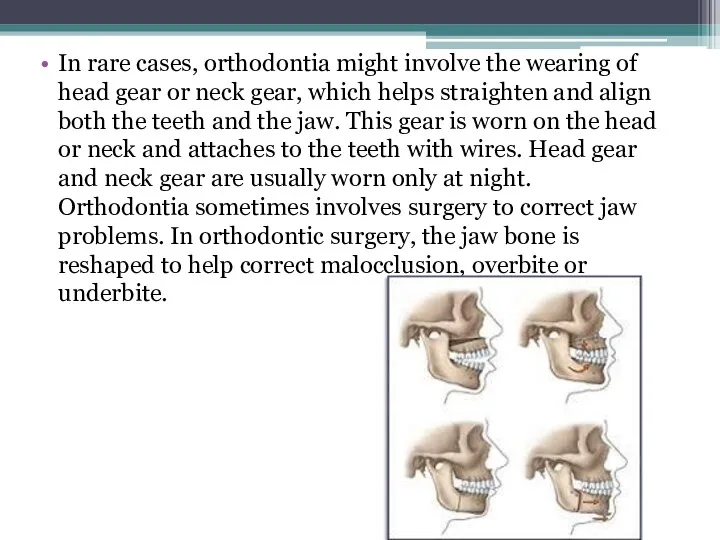In rare cases, orthodontia might involve the wearing of head