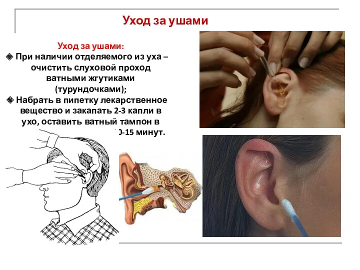 Уход за ушами: При наличии отделяемого из уха – очистить