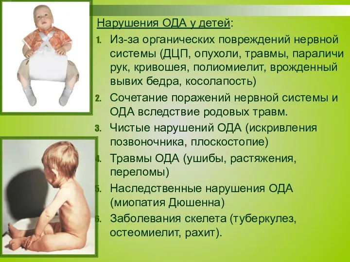 Нарушения ОДА у детей: Из-за органических повреждений нервной системы (ДЦП, опухоли, травмы, параличи