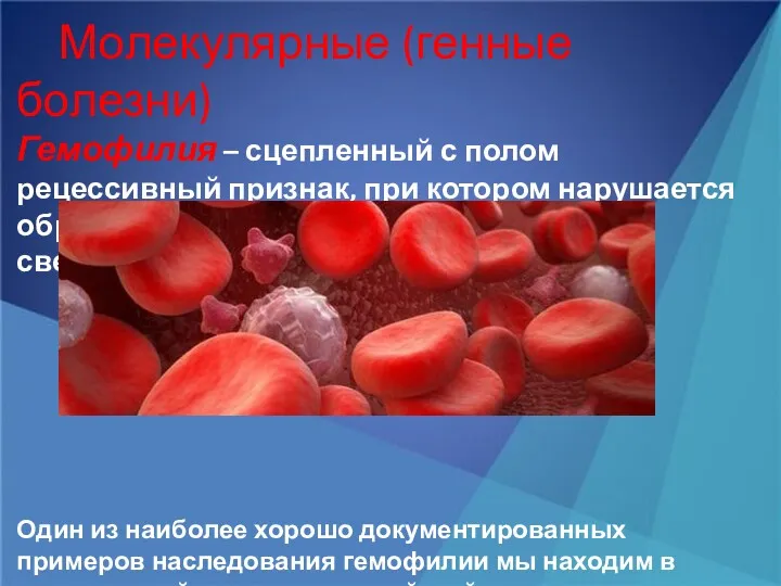 Молекулярные (генные болезни) Гемофилия – сцепленный с полом рецессивный признак, при котором нарушается