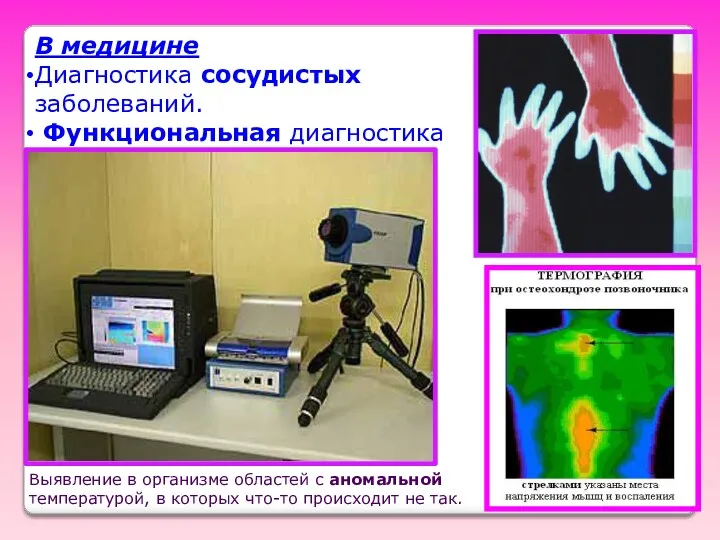 В медицине Диагностика сосудистых заболеваний. Функциональная диагностика Выявление в организме