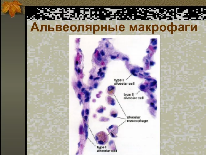 Альвеолярные макрофаги