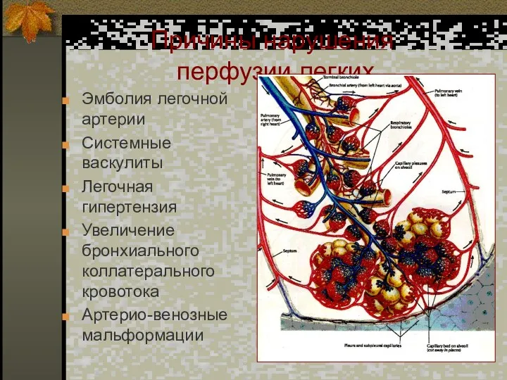 Причины нарушения перфузии легких Эмболия легочной артерии Системные васкулиты Легочная