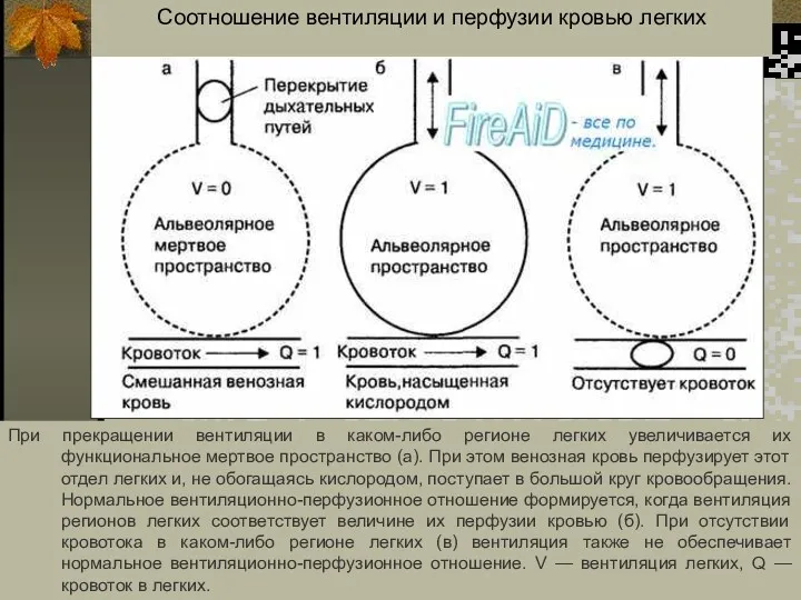 Соотношение вентиляции и перфузии кровью легких При прекращении вентиляции в