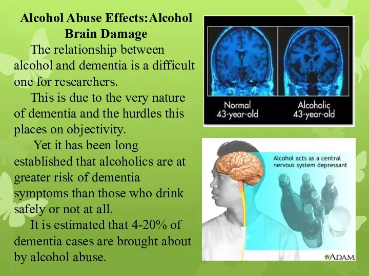 Alcohol Abuse Effects:Alcohol Brain Damage The relationship between alcohol and
