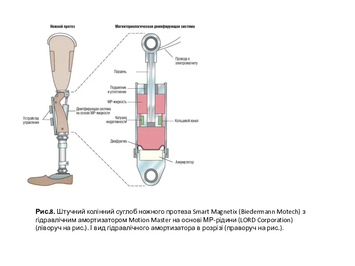 Рис.8. Штучний колінний суглоб ножного протеза Smart Magnetix (Biedermann Motech)
