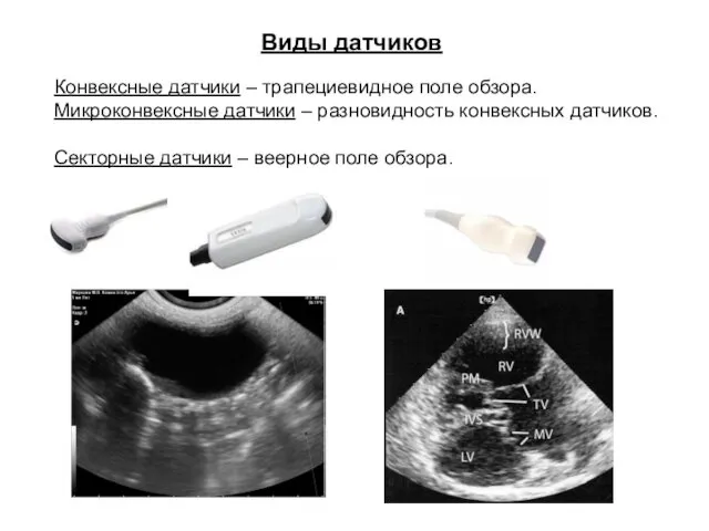 Конвексные датчики – трапециевидное поле обзора. Микроконвексные датчики – разновидность