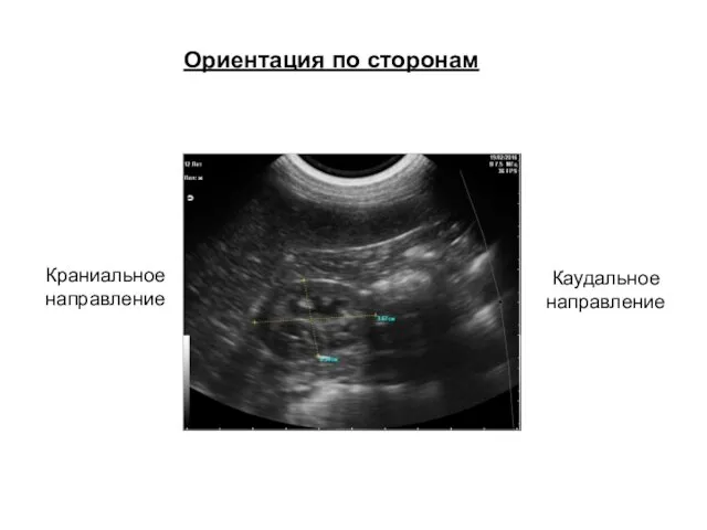 Ориентация по сторонам Краниальное направление Каудальное направление