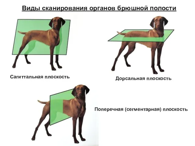 Сагиттальная плоскость Дорсальная плоскость Поперечная (сегментарная) плоскость Виды сканирования органов брюшной полости