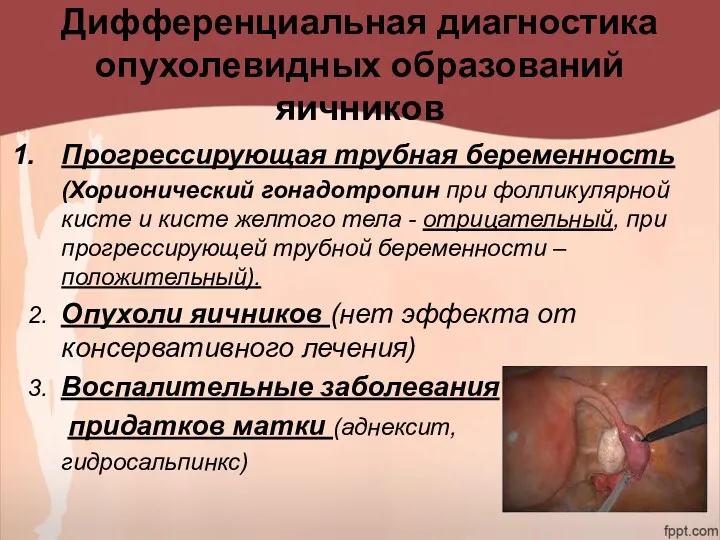 Дифференциальная диагностика опухолевидных образований яичников Прогрессирующая трубная беременность (Хорионический гонадотропин при фолликулярной кисте