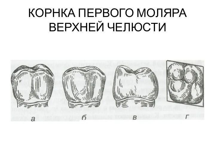 КОРНКА ПЕРВОГО МОЛЯРА ВЕРХНЕЙ ЧЕЛЮСТИ