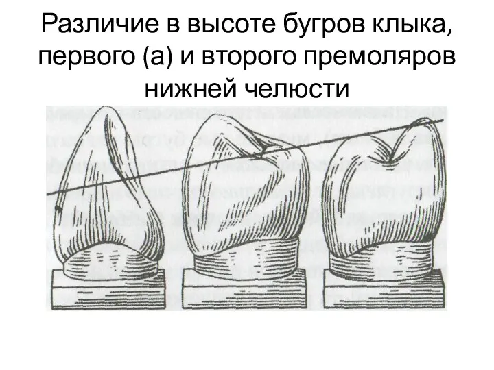 Различие в высоте бугров клыка, первого (а) и второго премоляров нижней челюсти