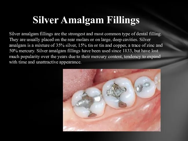 Silver amalgam fillings are the strongest and most common type