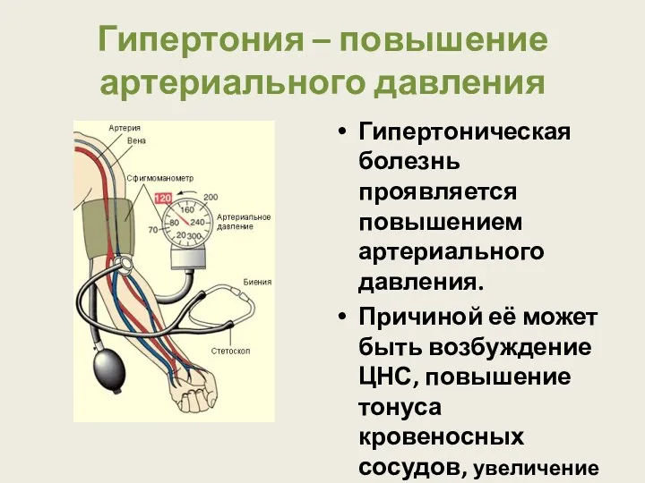 Гипертония – повышение артериального давления Гипертоническая болезнь проявляется повышением артериального