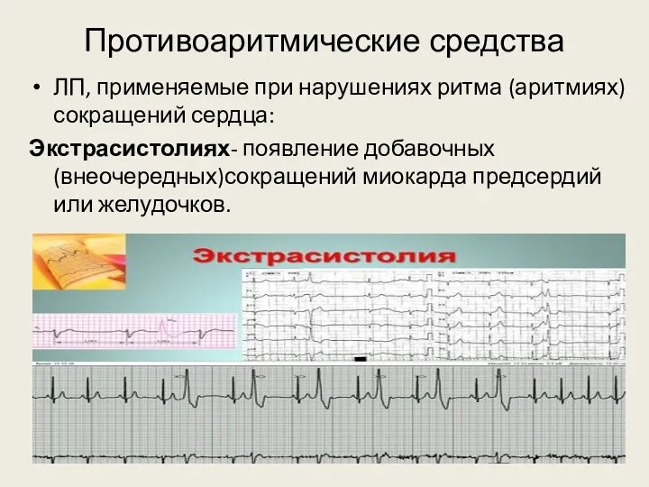 Противоаритмические средства ЛП, применяемые при нарушениях ритма (аритмиях) сокращений сердца: