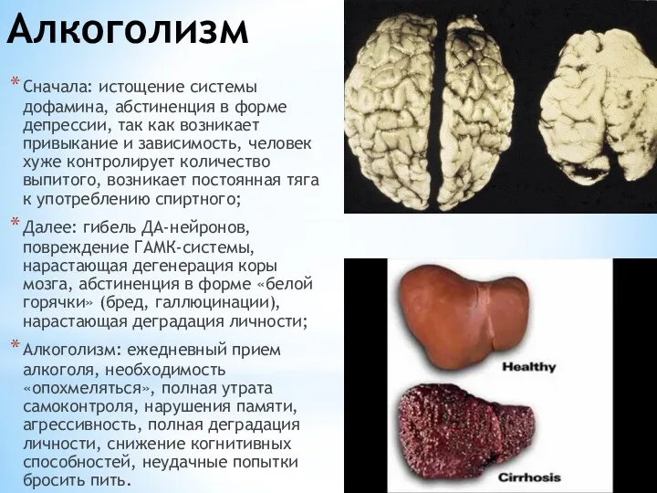 Алкоголизм Сначала: истощение системы дофамина, абстиненция в форме депрессии, так