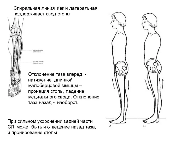 Спиральная линия, как и латеральная, поддерживает свод стопы Отклонение таза