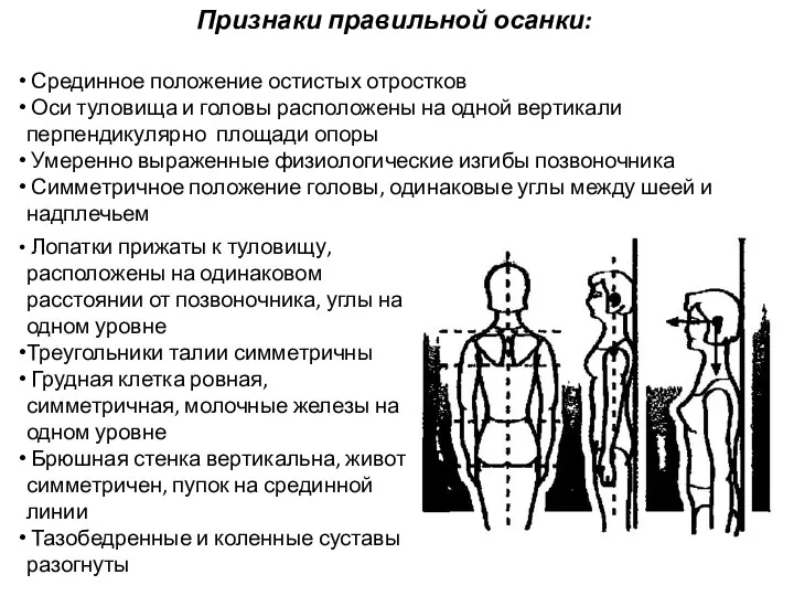 Признаки правильной осанки: Срединное положение остистых отростков Оси туловища и