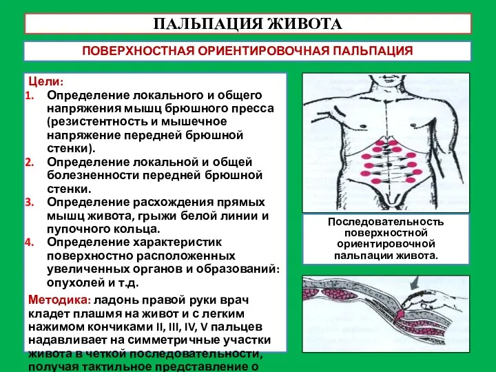 ПАЛЬПАЦИЯ ЖИВОТА ПОВЕРХНОСТНАЯ ОРИЕНТИРОВОЧНАЯ ПАЛЬПАЦИЯ Цели: Определение локального и общего