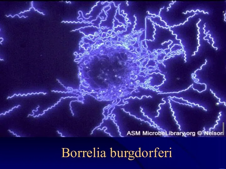 Borrelia burgdorferi