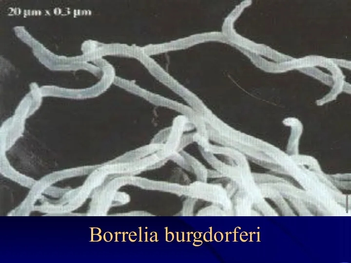 Borrelia burgdorferi