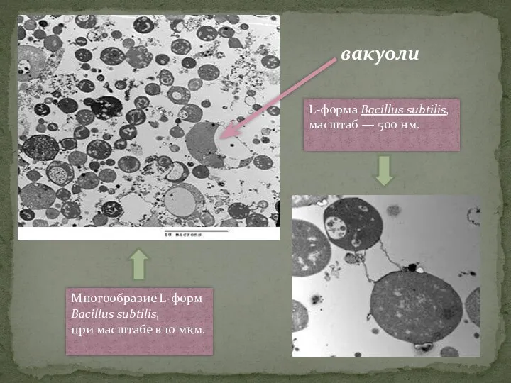 Многообразие L-форм Bacillus subtilis, при масштабе в 10 мкм. L-форма