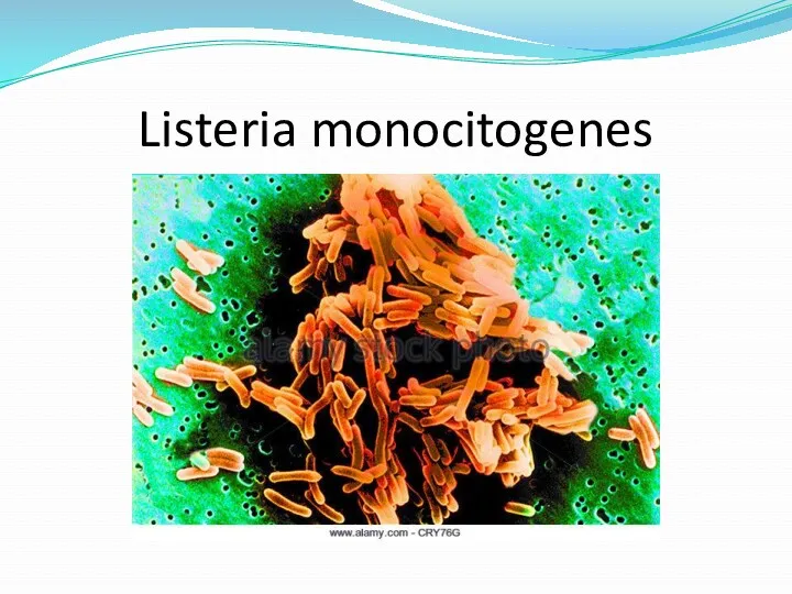 Listeria monocitogenes