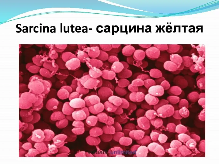 Sarcina lutea- сарцина жёлтая