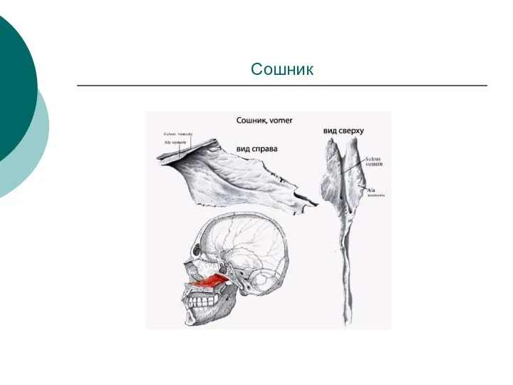 Сошник