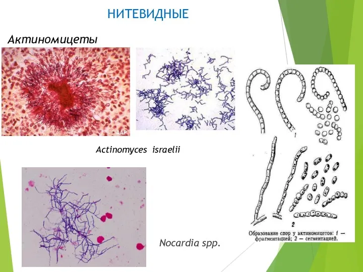 НИТЕВИДНЫЕ Nocardia spp. Актиномицеты Actinomyces israelii