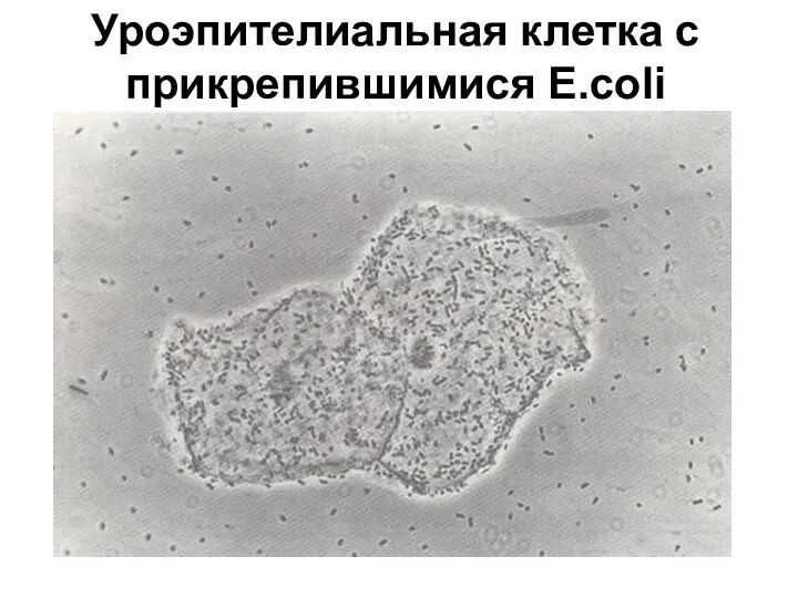 Уроэпителиальная клетка с прикрепившимися E.coli