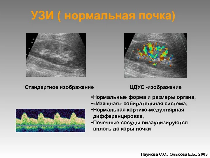 УЗИ ( нормальная почка) ЦДУС -изображение Нормальные форма и размеры