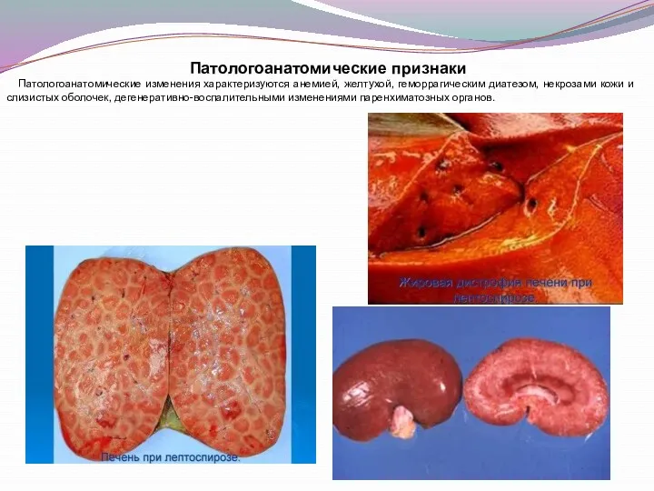 Патологоанатомические признаки Патологоанатомические изменения характеризуются анемией, желтухой, геморрагическим диатезом, некрозами