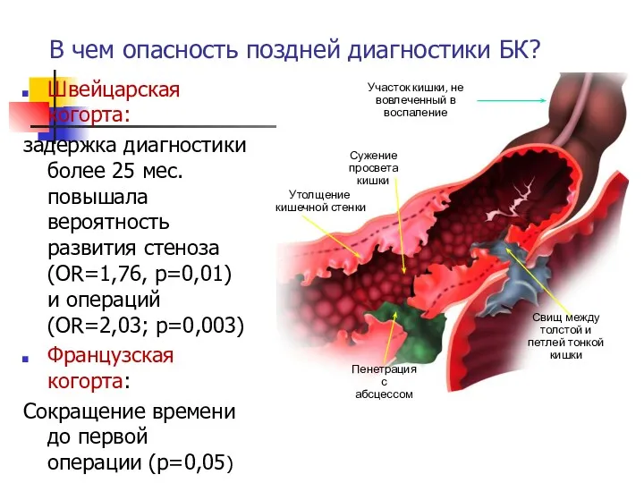 В чем опасность поздней диагностики БК? Швейцарская когорта: задержка диагностики