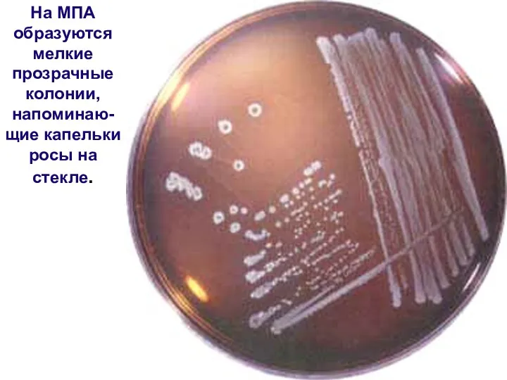 На МПА образуются мелкие прозрачные колонии, напоминаю-щие капельки росы на стекле.