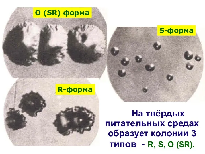 На твёрдых питательных средах образует колонии 3 типов - R, S, O (SR).