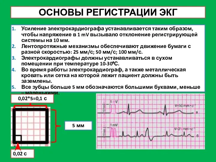 ОСНОВЫ РЕГИСТРАЦИИ ЭКГ Усиление электрокардиографа устанавливается таким образом, чтобы напряжение