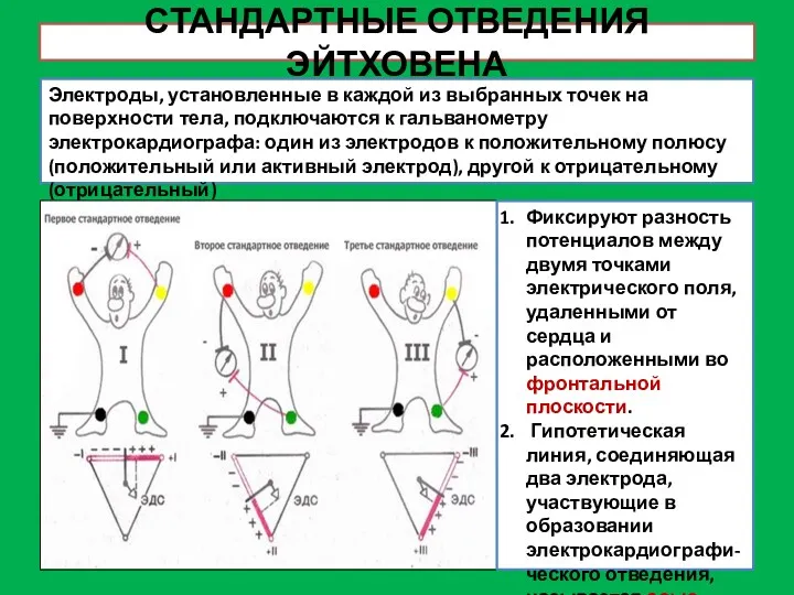 СТАНДАРТНЫЕ ОТВЕДЕНИЯ ЭЙТХОВЕНА Электроды, установленные в каждой из выбранных точек