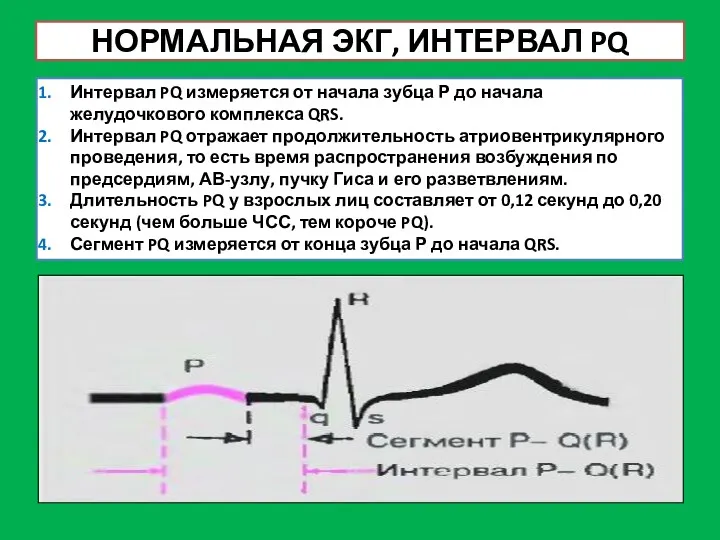 НОРМАЛЬНАЯ ЭКГ, ИНТЕРВАЛ PQ Интервал PQ измеряется от начала зубца