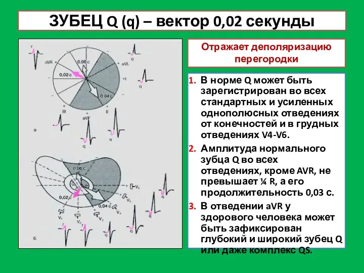 ЗУБЕЦ Q (q) – вектор 0,02 секунды Отражает деполяризацию перегородки