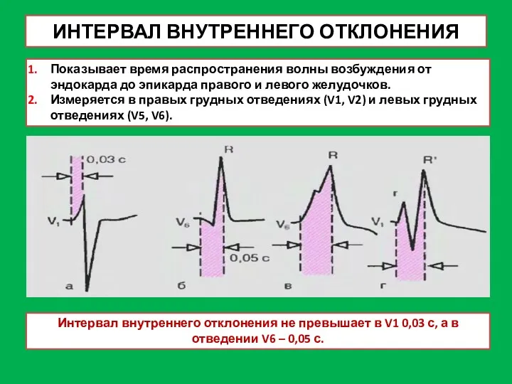 ИНТЕРВАЛ ВНУТРЕННЕГО ОТКЛОНЕНИЯ Показывает время распространения волны возбуждения от эндокарда