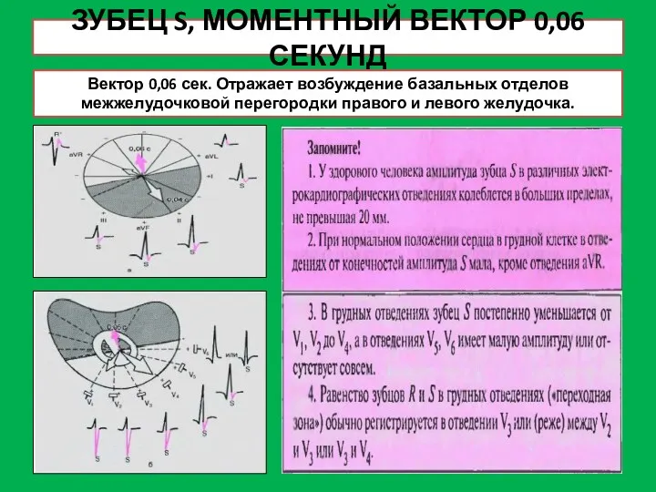 ЗУБЕЦ S, МОМЕНТНЫЙ ВЕКТОР 0,06 СЕКУНД Вектор 0,06 сек. Отражает