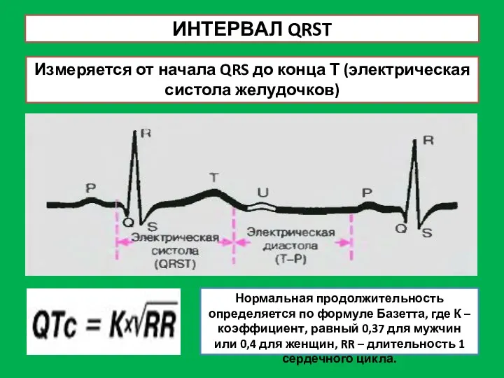 ИНТЕРВАЛ QRST Измеряется от начала QRS до конца Т (электрическая