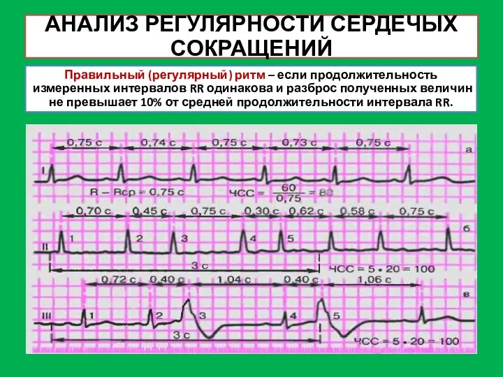 АНАЛИЗ РЕГУЛЯРНОСТИ СЕРДЕЧЫХ СОКРАЩЕНИЙ Правильный (регулярный) ритм – если продолжительность