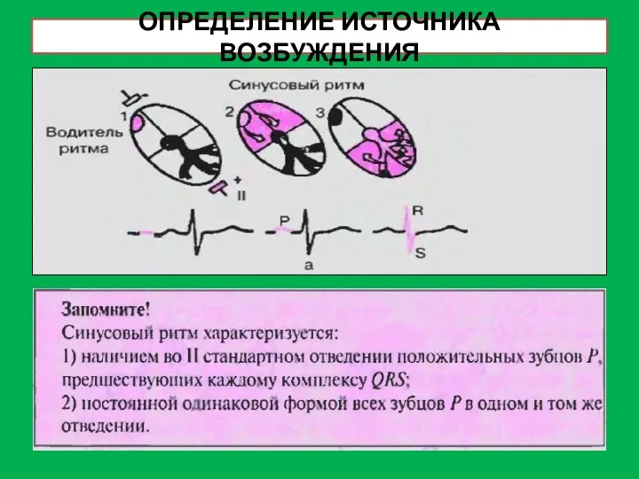 ОПРЕДЕЛЕНИЕ ИСТОЧНИКА ВОЗБУЖДЕНИЯ