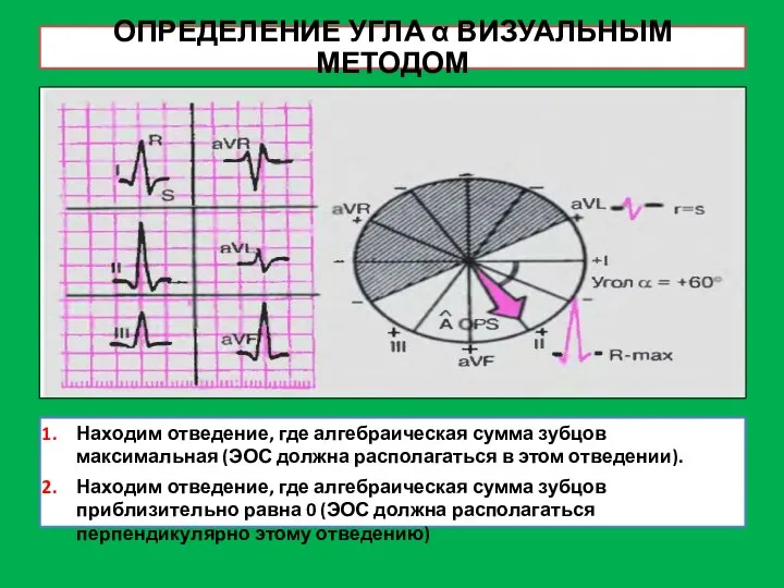 ОПРЕДЕЛЕНИЕ УГЛА α ВИЗУАЛЬНЫМ МЕТОДОМ Находим отведение, где алгебраическая сумма