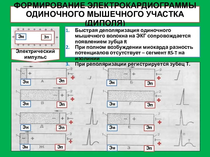 ФОРМИРОВАНИЕ ЭЛЕКТРОКАРДИОГРАММЫ ОДИНОЧНОГО МЫШЕЧНОГО УЧАСТКА (ДИПОЛЯ) Электрический импульс Эп Эп